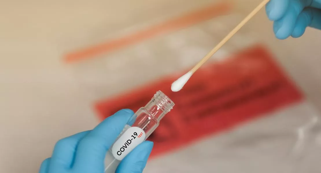 A kormány szerezzen be otthon is elvégezhető koronavírus-tesztet, ha már a tömeges állami tesztelés kudarcba fulladt 
